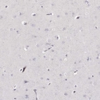 Immunohistochemical staining of human cerebral cortex shows low expression as expected.