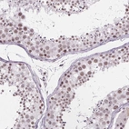 Immunohistochemical staining of human testis shows high expression.