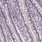 Immunohistochemical staining of human duodenum shows low expression as expected.