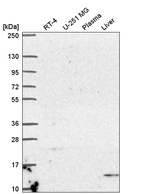 Western blot analysis in human cell line RT-4, human cell line U-251 MG, human plasma and human liver tissue.