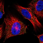 Immunofluorescent staining of human cell line U-251 MG shows localization to vesicles.