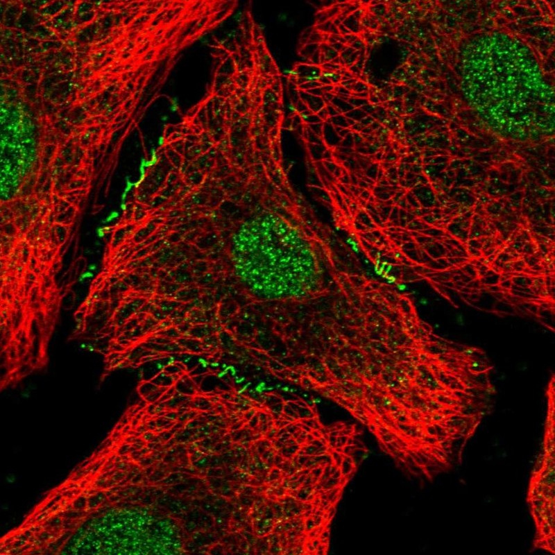 Anti-FOXA2 Antibody