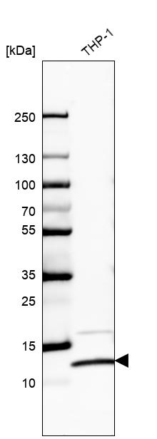 Anti-RPS27L Antibody