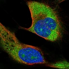 Immunofluorescent staining of human cell line U-2 OS shows localization to nucleoli, cytosol & endoplasmic reticulum.