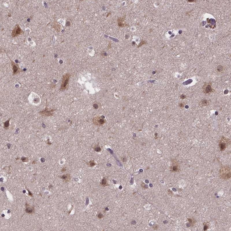 Anti-FAM181B Antibody