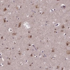 Anti-FAM181B Antibody