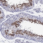 Immunohistochemical staining of human testis shows high expression.