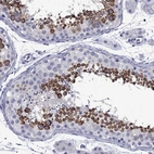 Immunohistochemical staining of human testis shows high expression.