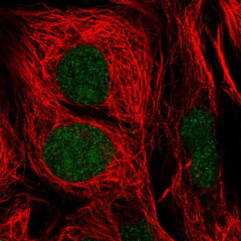 Anti-GTF2E1 Antibody