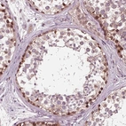 Anti-NUP210 Antibody