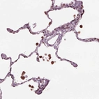 Immunohistochemical staining of human lung shows strong nuclear positivity in monocytes.