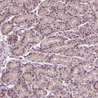 Immunohistochemical staining of human stomach shows moderate nuclear and cytoplasmic positivity in glandular cells.
