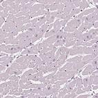 Immunohistochemical staining of human heart muscle shows no positivity in cardiomyocytes as expected.
