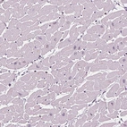 Immunohistochemical staining of human heart muscle shows no positivity in cardiomyocytes as expected.