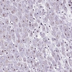 Anti-ATMIN Antibody
