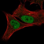 Anti-CDK2 Antibody