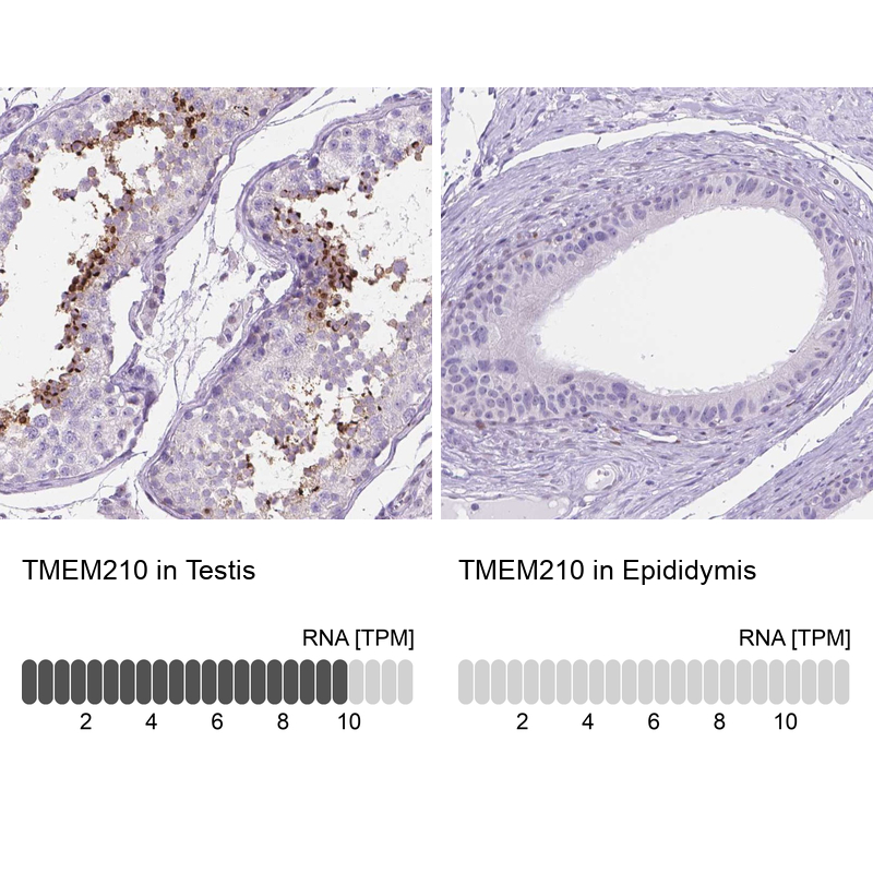 Anti-TMEM210 Antibody
