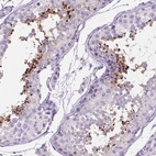 Immunohistochemical staining of human testis shows high expression.
