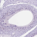 Immunohistochemical staining of human epididymis shows low expression as expected.