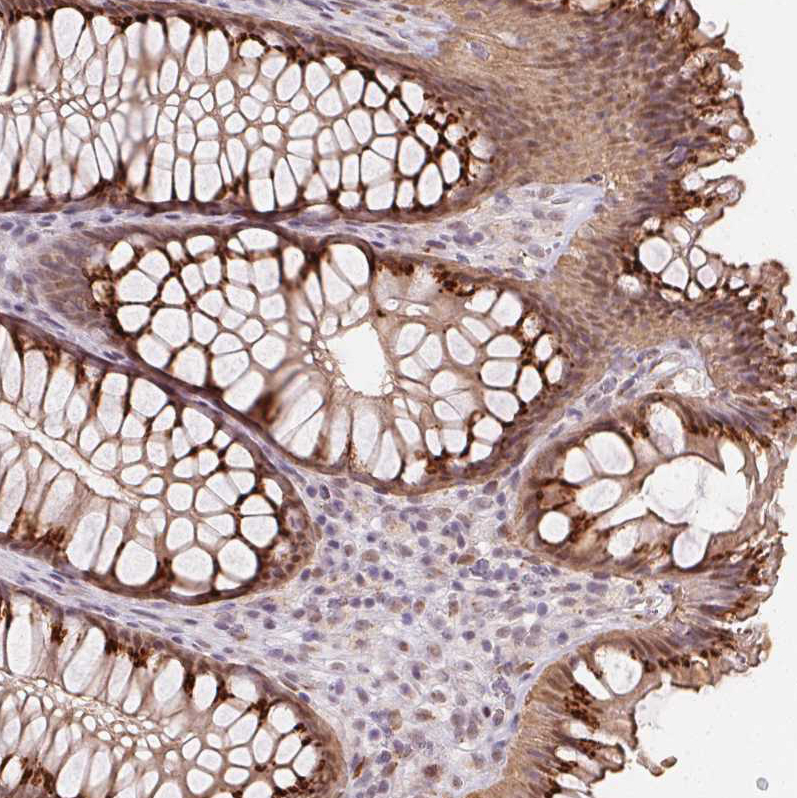 Anti-RAB22A Antibody
