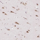 Immunohistochemical staining of human cerebral cortex shows strong granular cytoplasmic positivity in neurons.