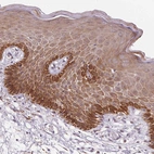 Immunohistochemical staining of human skin shows strong membranous and granular cytoplasmic positivity in squamous epithelial cells.