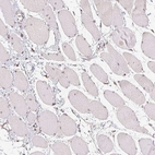 Immunohistochemical staining of human skeletal muscle shows no cytoplasmic positivity in myocytes as expected.