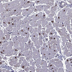 Immunohistochemical staining of human heart muscle shows strong nuclear positivity in cardiomyocytes with weak cytoplasmic positivity.