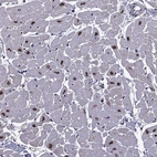Immunohistochemical staining of human heart muscle shows strong nuclear positivity in cardiomyocytes with weak cytoplasmic positivity.