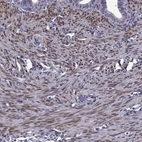 Immunohistochemical staining of human fallopian tube shows moderate nuclear positivity in smooth muscle cells.