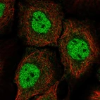 Immunofluorescent staining of human cell line HaCaT shows localization to nucleoplasm.