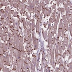 Anti-COMMD4 Antibody