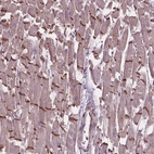 Anti-COMMD4 Antibody