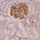 Anti-TSPO2 Antibody
