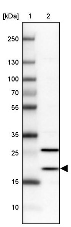 Anti-BTF3L4 Antibody