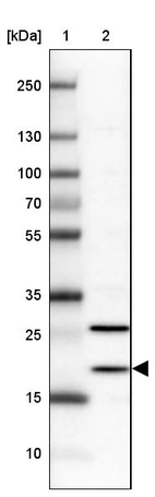 Lane 1: Marker [kDa] 250, 130, 100, 70, 55, 35, 25, 15, 10_br/_Lane 2: Human cell line NTERA-2
