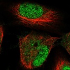 Anti-HRCT1 Antibody