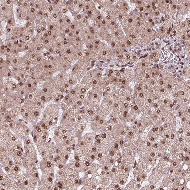 Anti-SNRNP35 Antibody