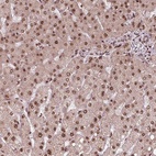 Anti-SNRNP35 Antibody