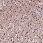 Anti-SNRNP35 Antibody
