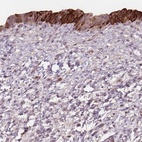 Anti-TMEM80 Antibody