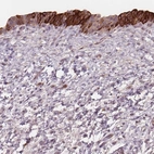 Anti-TMEM80 Antibody