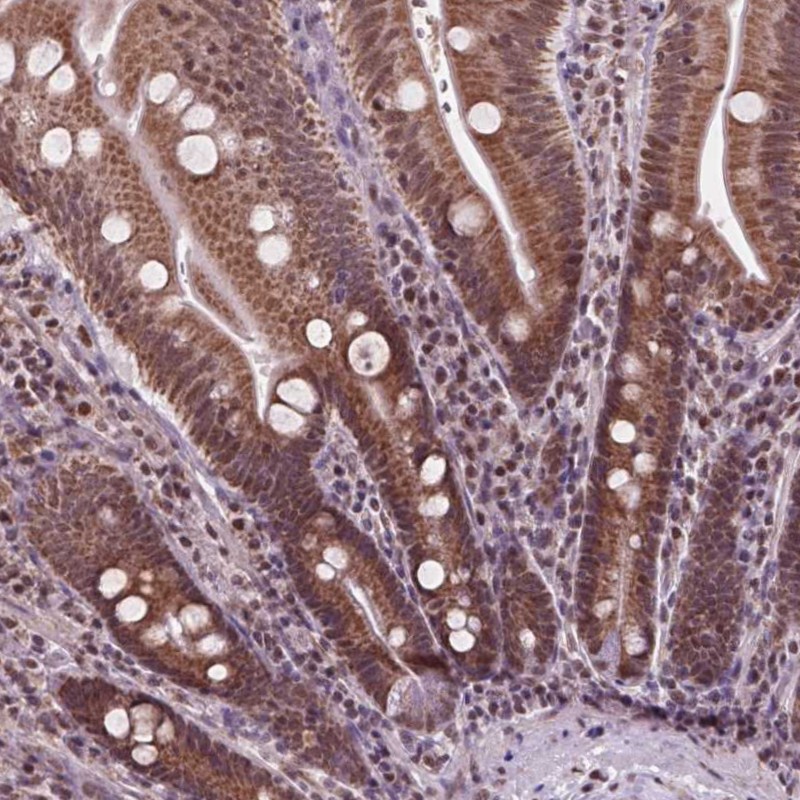 Anti-NDUFA10 Antibody