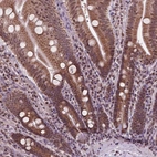 Anti-NDUFA10 Antibody