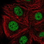 Anti-CDK10 Antibody