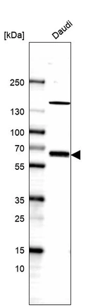 Anti-TFEB Antibody
