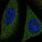 Immunofluorescent staining of human cell line HeLa shows localization to cytosol.