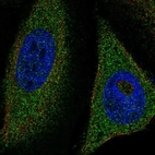 Immunofluorescent staining of human cell line HeLa shows localization to cytosol.
