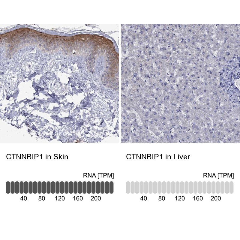 Anti-CTNNBIP1 Antibody