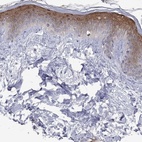Immunohistochemical staining of human skin shows high expression.